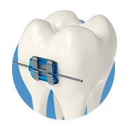 Orthodontics Supplies