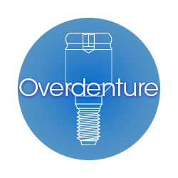 Overdenture