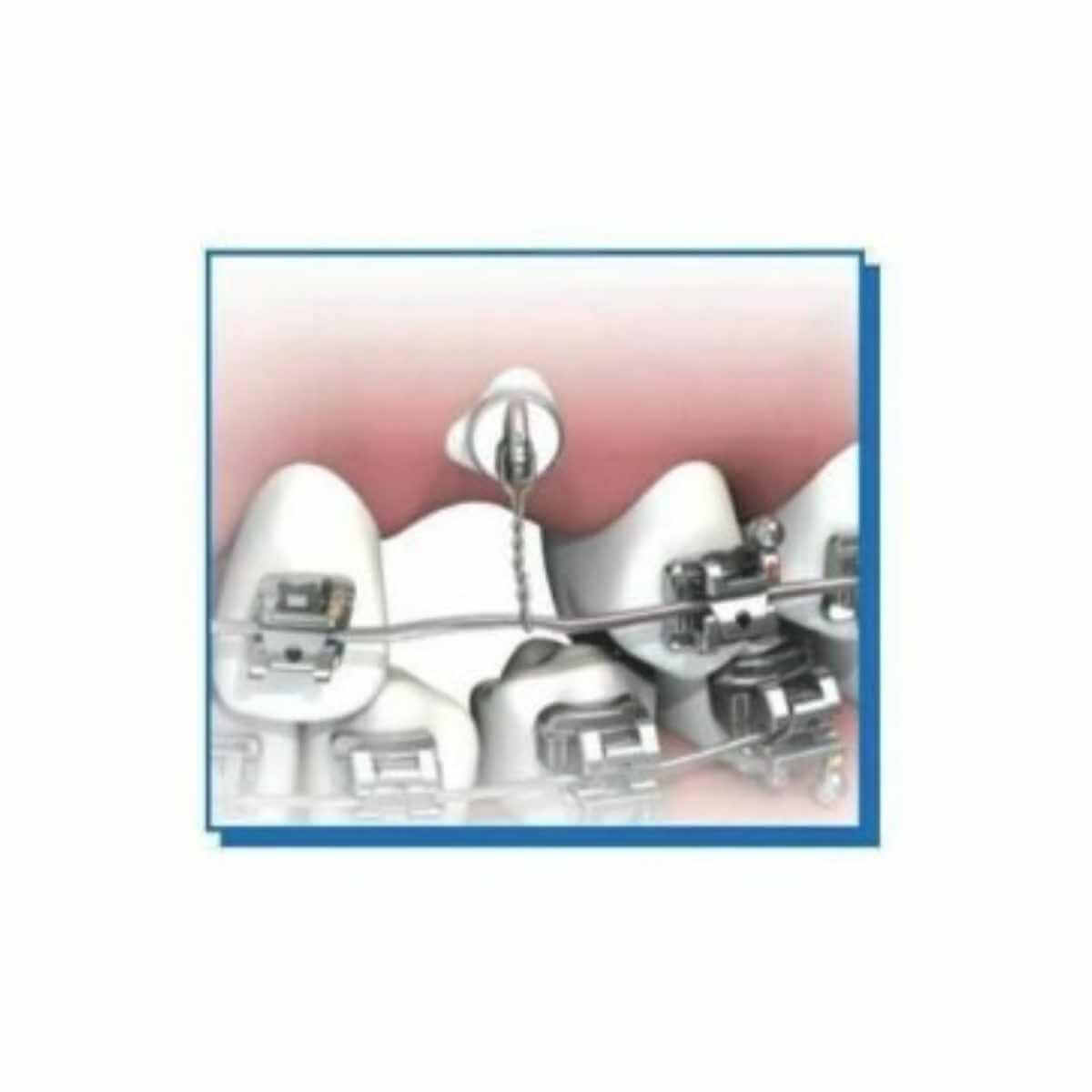 Boutons de chaîne de traction orthodontique Morelli 10 pcs