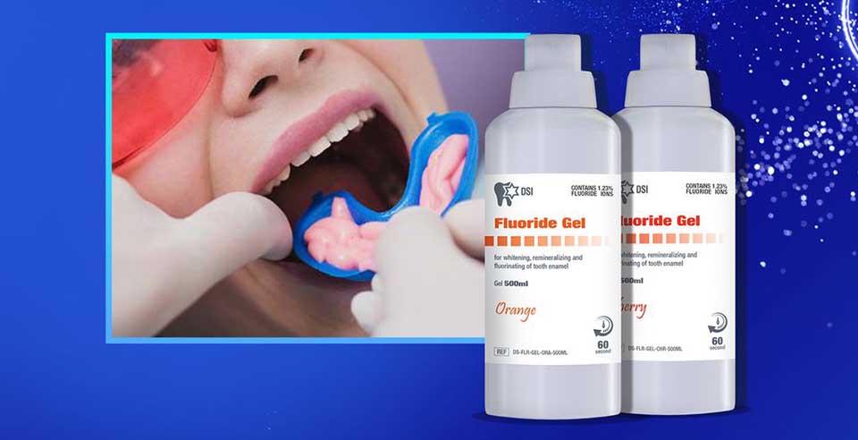 DSI Fluoride Gel- Low Cost, Quick Treatment