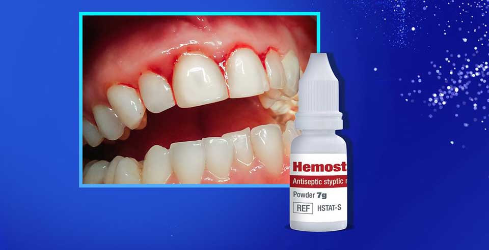 DSI Hemostatic Liquid- Aluminum Chloride for Safe and Discoloration-Free Hemostatic Action