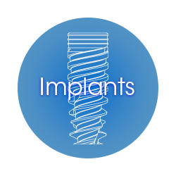 Implants