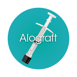 Allograft Bone Graft