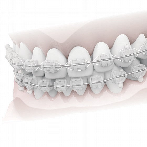 Fils de ligature en CrNi esthétiques revêtus Morelli Orthodontie 0,25 mm 10 m en bobine